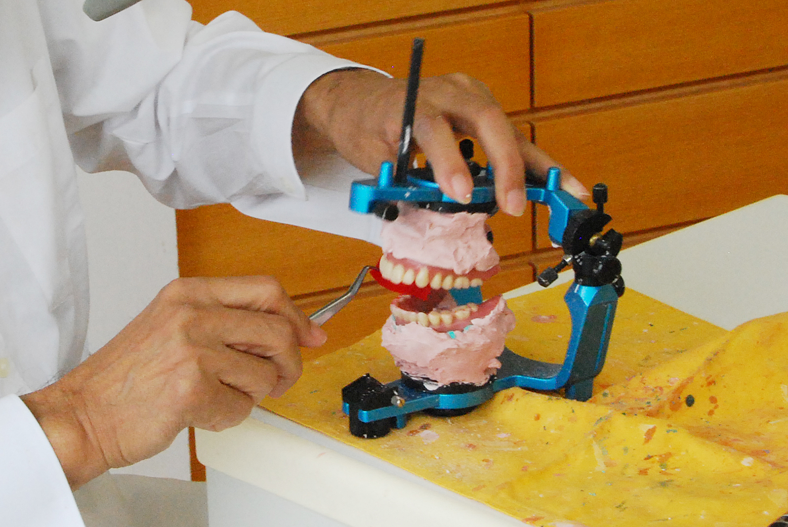 入れ歯調整の重要性2 前歯でも噛める入れ歯研究会